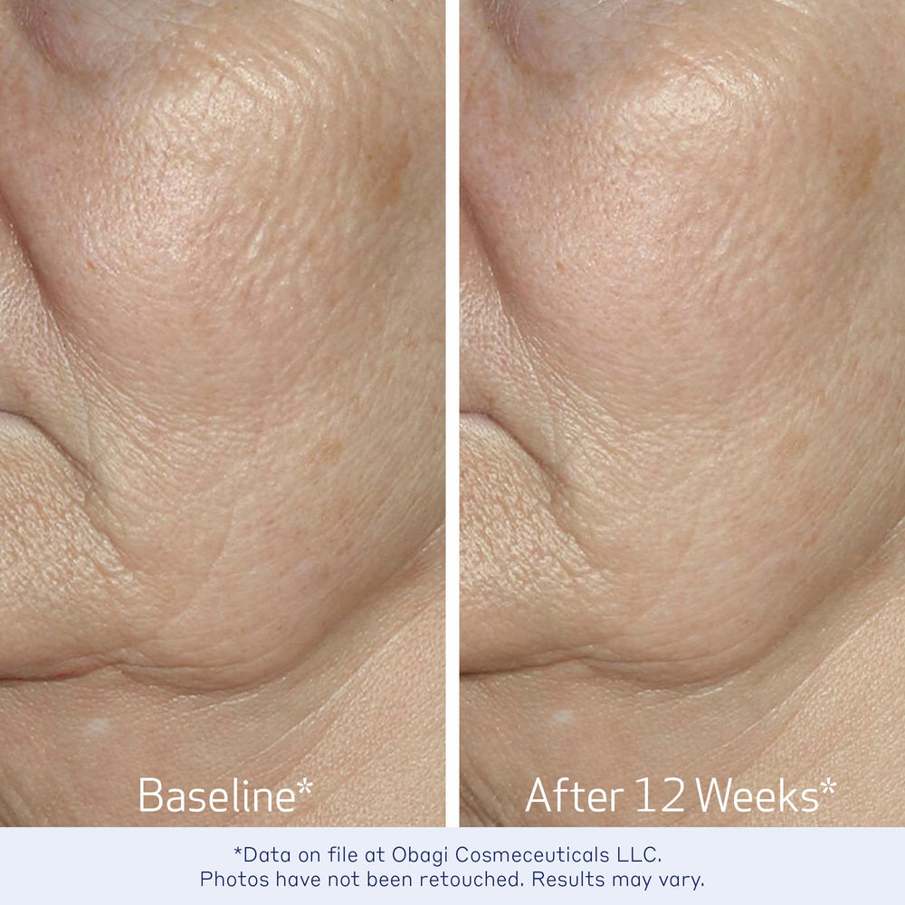 Obagi ELASTIderm 1oz bottle scale comparison demonstrating compact travel-friendly size