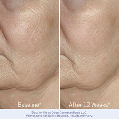 Obagi ELASTIderm 1oz bottle scale comparison demonstrating compact travel-friendly size