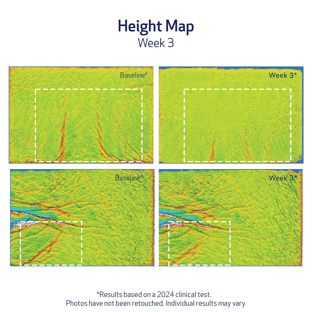 Obagi ELASTIderm clinical results chart graphic, highlights measured improvements in elasticity