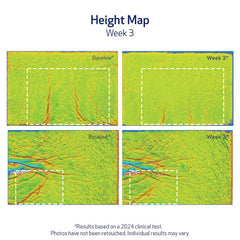 Obagi ELASTIderm clinical results chart graphic, highlights measured improvements in elasticity