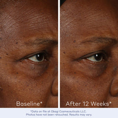 Obagi ELASTIderm drop on hand showing easy spreadability and immediate absorption