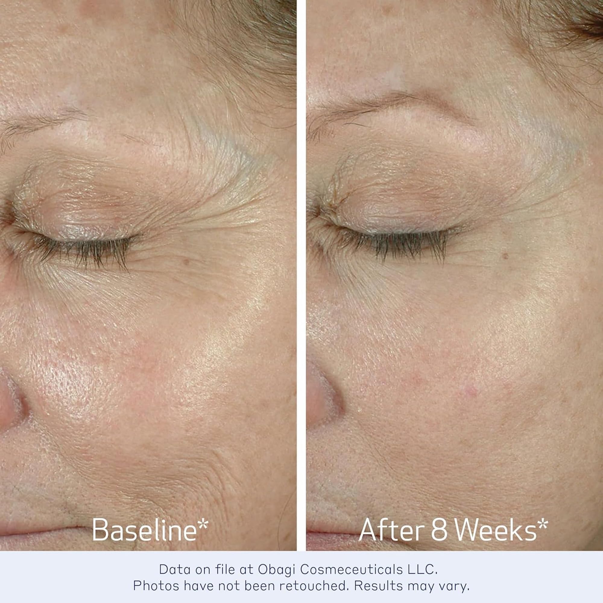 Obagi Medical cream applied on hand demonstrating smooth, non-greasy finish