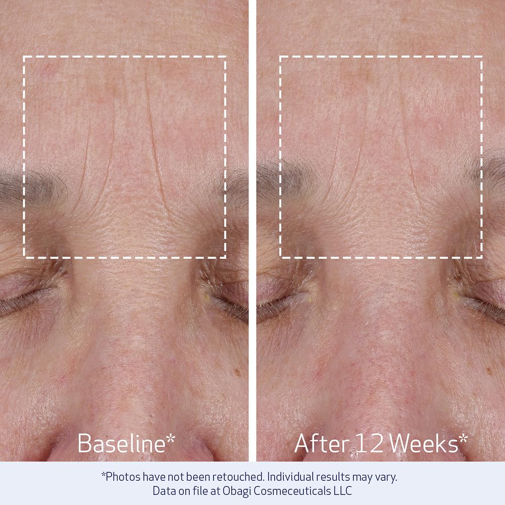 Obagi ELASTIderm label and directions close-up, helps users follow recommended application