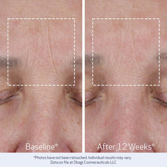 Obagi ELASTIderm label and directions close-up, helps users follow recommended application