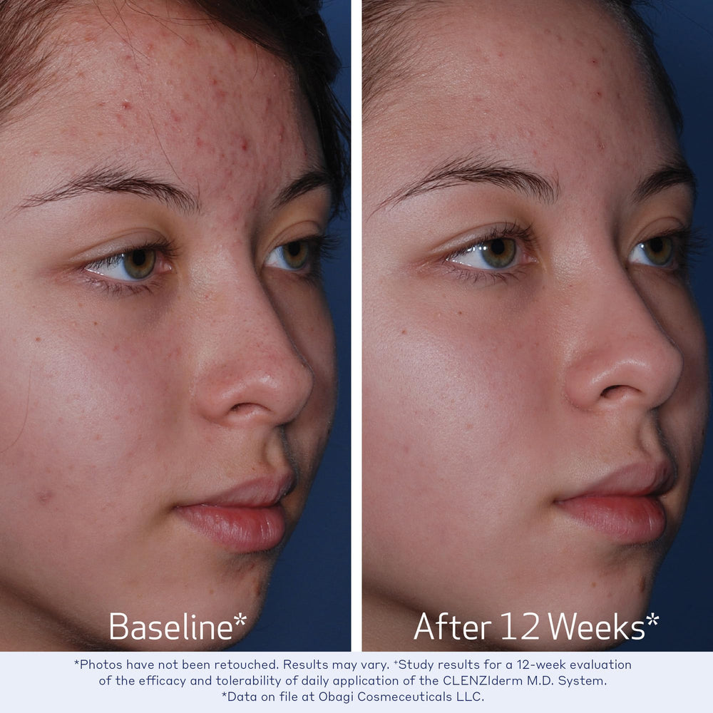 Obagi Medical close up label highlighting 2% salicylic acid benefit