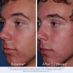 Obagi Medical texture foam detail showing lightweight cleansing benefit