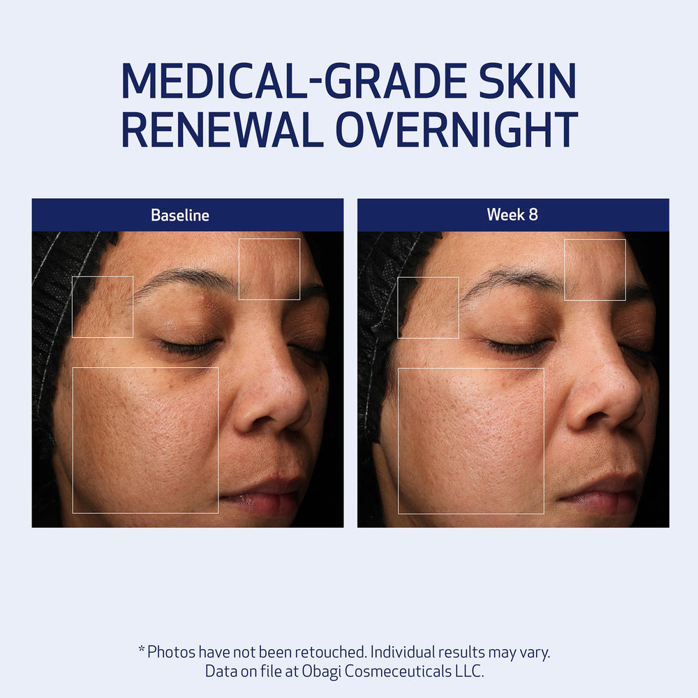 Obagi Medical ingredient display highlighting retinol and PHA benefits