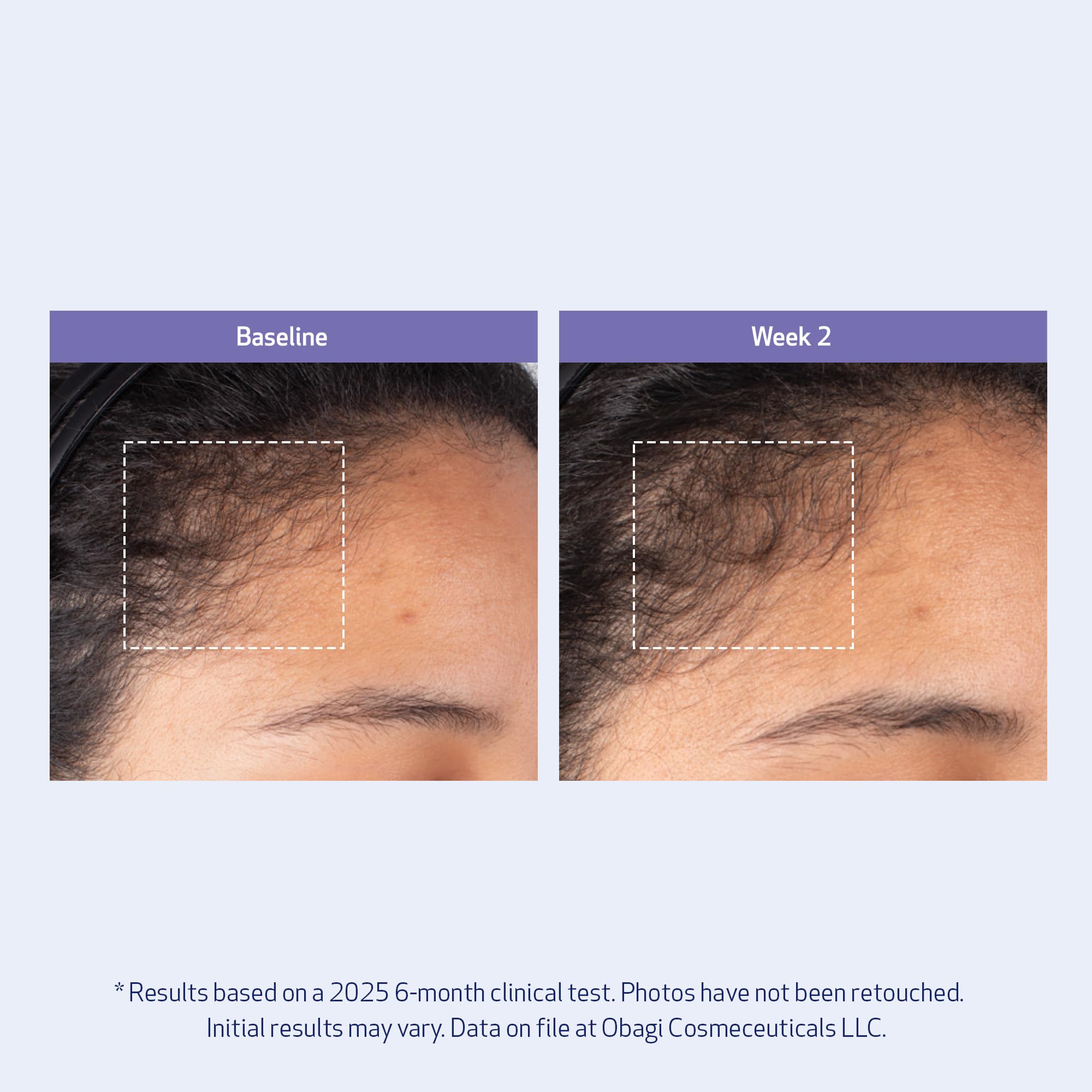 Obagi Nu-Cil before and after hair styling showing fuller-looking results