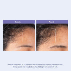 Obagi Nu-Cil before and after hair styling showing fuller-looking results