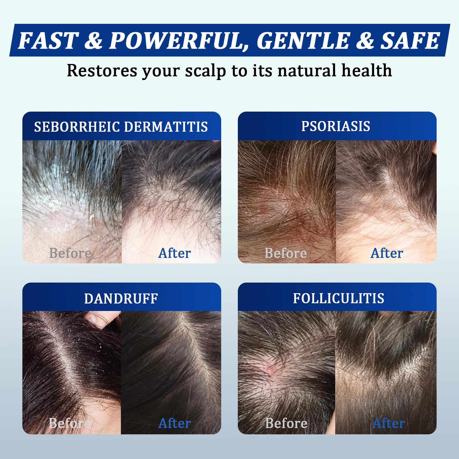 oely in-shower use lifestyle image showing gentle daily scalp care