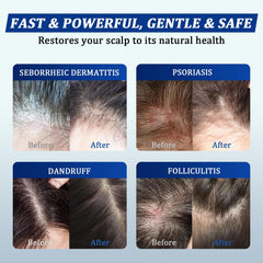 oely in-shower use lifestyle image showing gentle daily scalp care