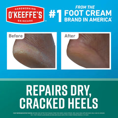 O'Keeffe's heel before and after showing smoother skin and visible improvement