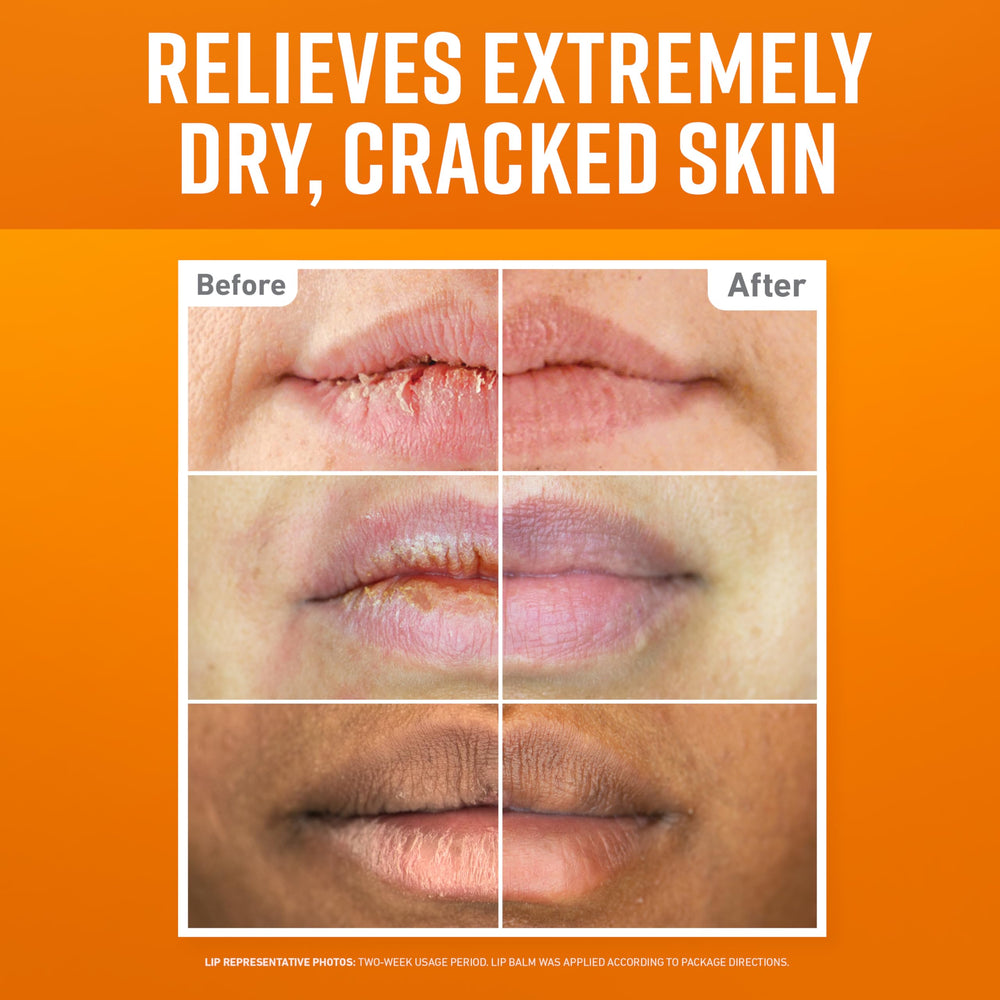 O'Keeffe's Cooling Relief stick close-up showing peppermint feel and soothing effect
