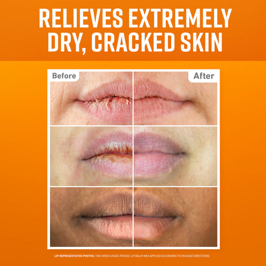 O'Keeffe's Cooling Relief stick close-up showing peppermint feel and soothing effect