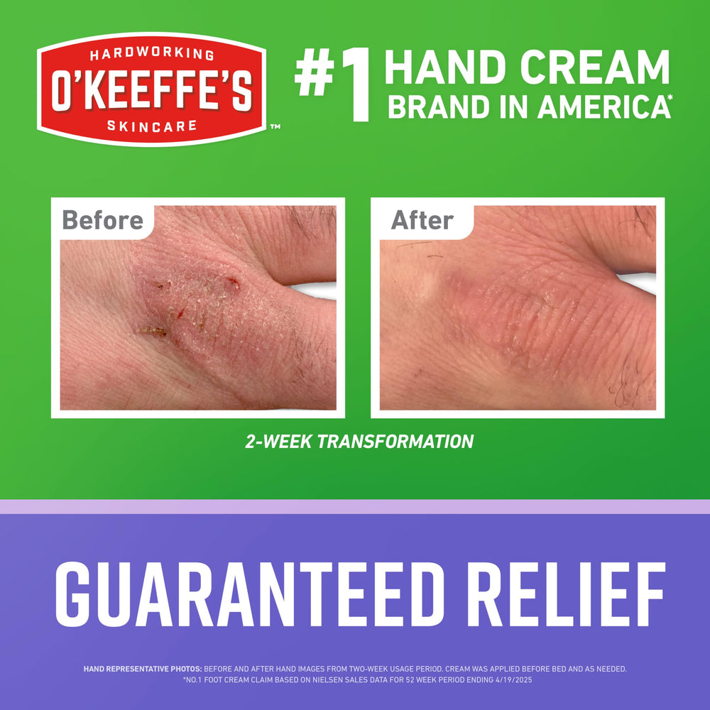O'Keeffe's Working Hands cream applied to skin demonstrating immediate relief