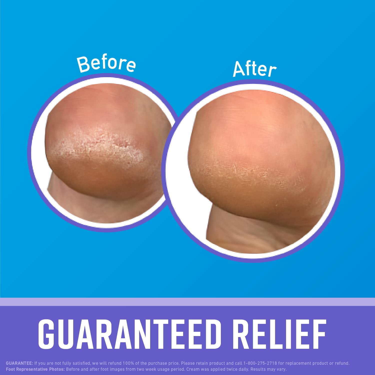 applying O'Keeffe's Healthy Feet cream to heels before bedtime to soften skin
