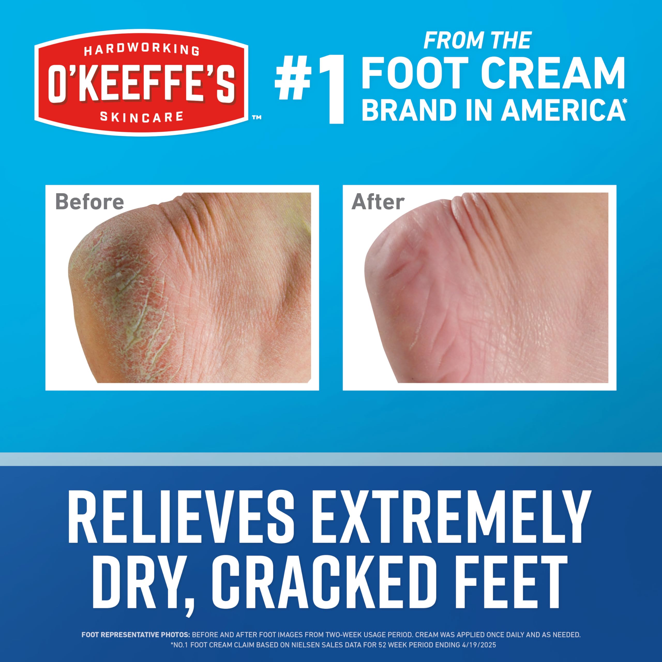 O'Keeffe's cream texture at cap illustrating non-greasy moisturizing benefit
