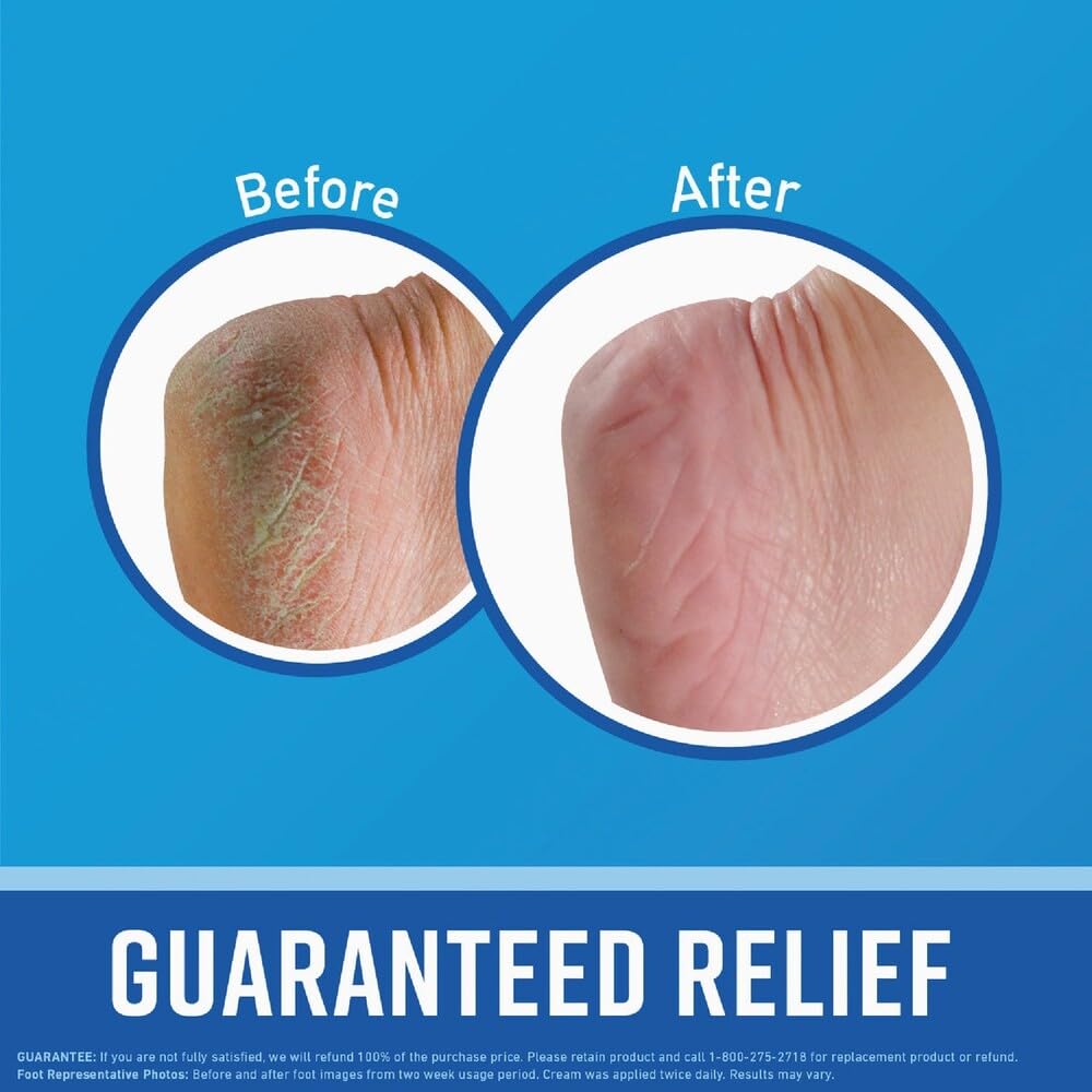 O'Keeffe's cream texture close-up highlighting rich moisture for softening skin