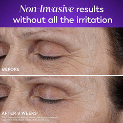 Olay cream application on face demonstrating easy nightly use and non-greasy feel