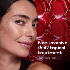 Olay eye roller open cap detail revealing roller tip for targeted, precise application