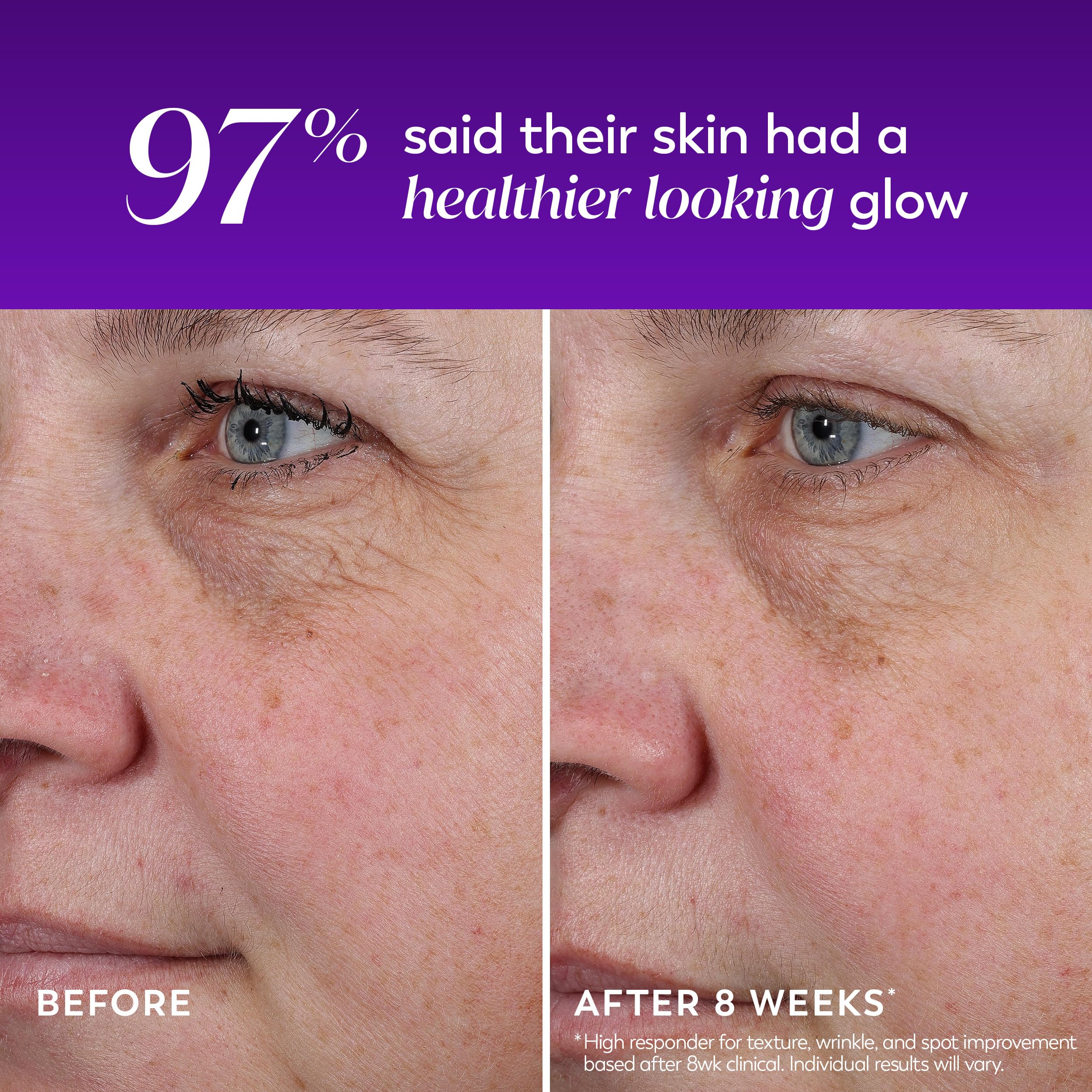 Olay product being applied at night demonstrating simple bedtime skincare step
