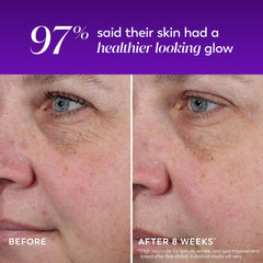 Olay product being applied at night demonstrating simple bedtime skincare step