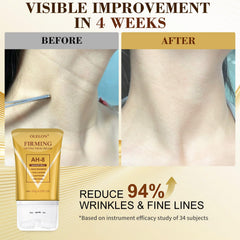 Person applying OLELON AH8 with roller to neck for lifted contour