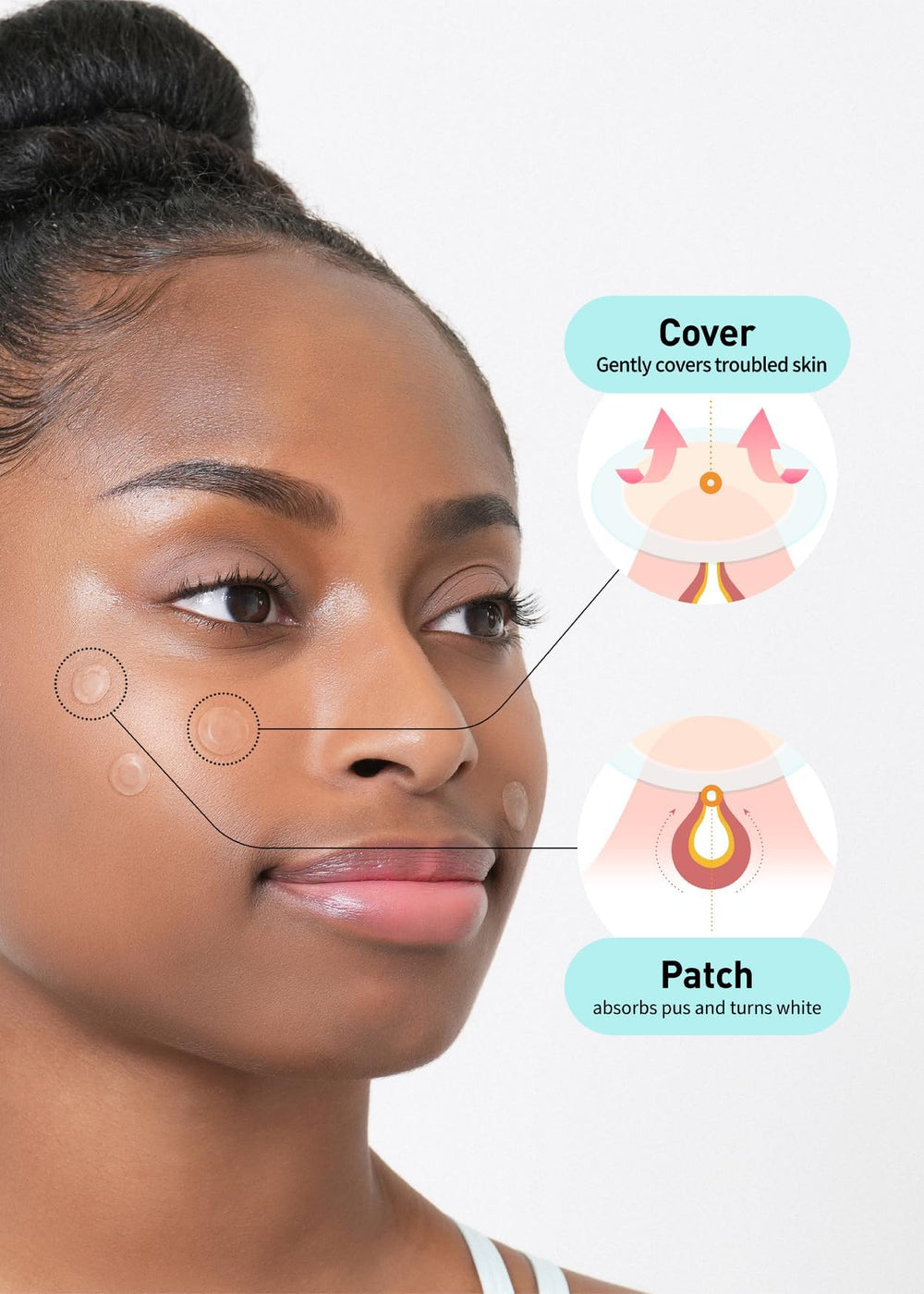 OLIVE YOUNG patch applied on cheek demonstrating protection and reduced picking
