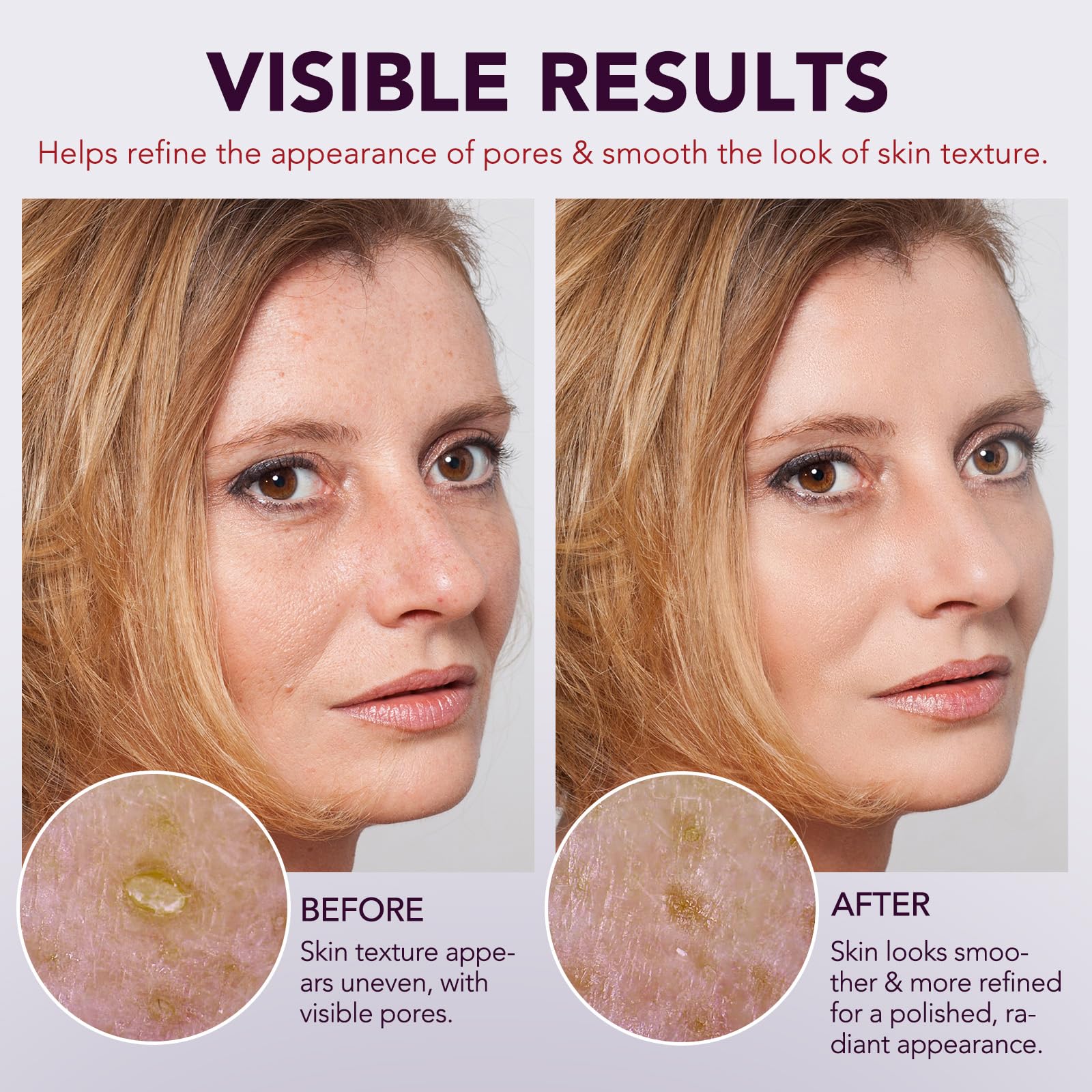 OMZOK applying ampoule to cheek, demonstrates pore-lifting action and smoothing