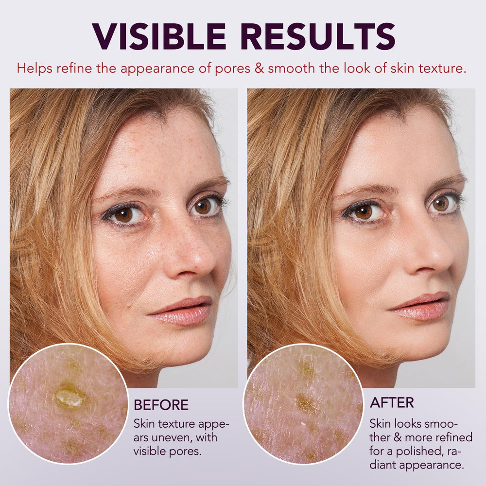 OMZOK applying ampoule to cheek, demonstrates pore-lifting action and smoothing