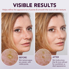 OMZOK applying ampoule to cheek, demonstrates pore-lifting action and smoothing