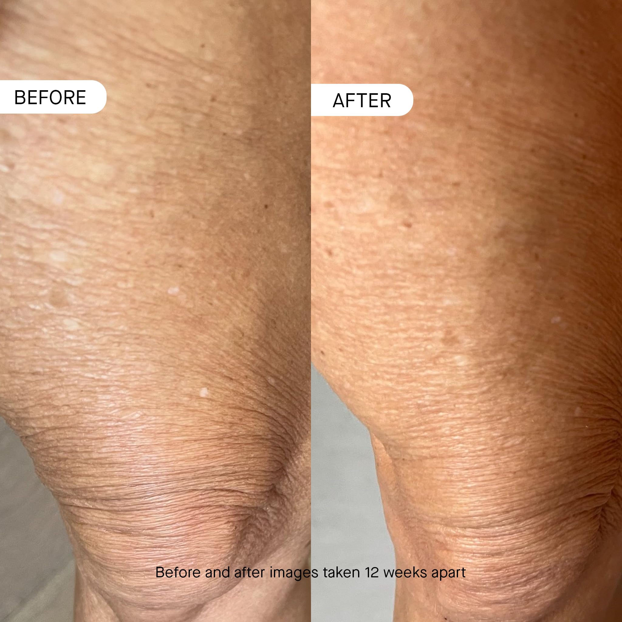 oneskin BODY OS-01 applied to forearm demonstrating quick absorption and soothing benefit