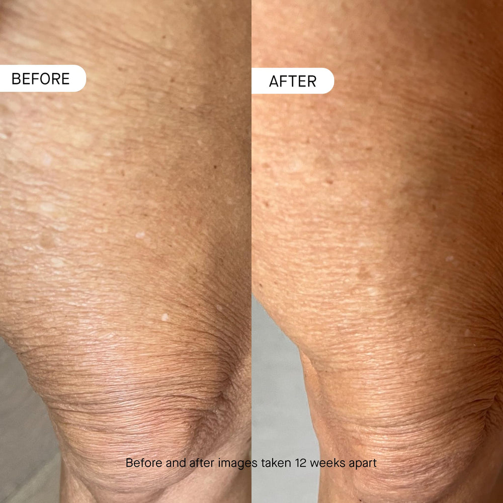 oneskin BODY OS-01 applied to forearm demonstrating quick absorption and soothing benefit