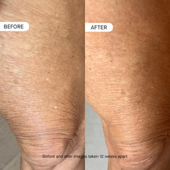 oneskin BODY OS-01 applied to forearm demonstrating quick absorption and soothing benefit
