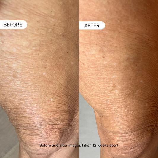 oneskin texture close-up displays lightweight lotion, absorbs quickly