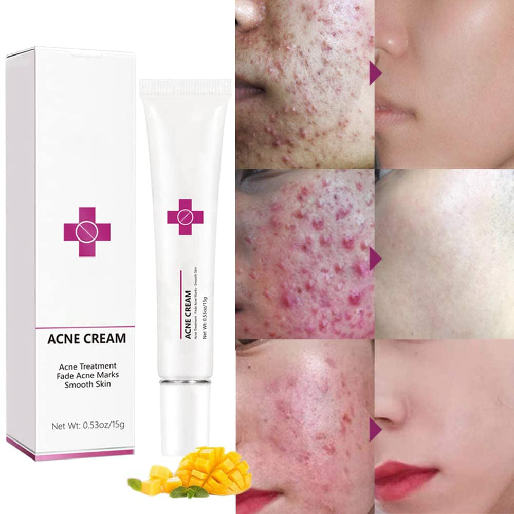 Onkessy cream texture close-up highlighting smooth, non-greasy finish for easy absorption
