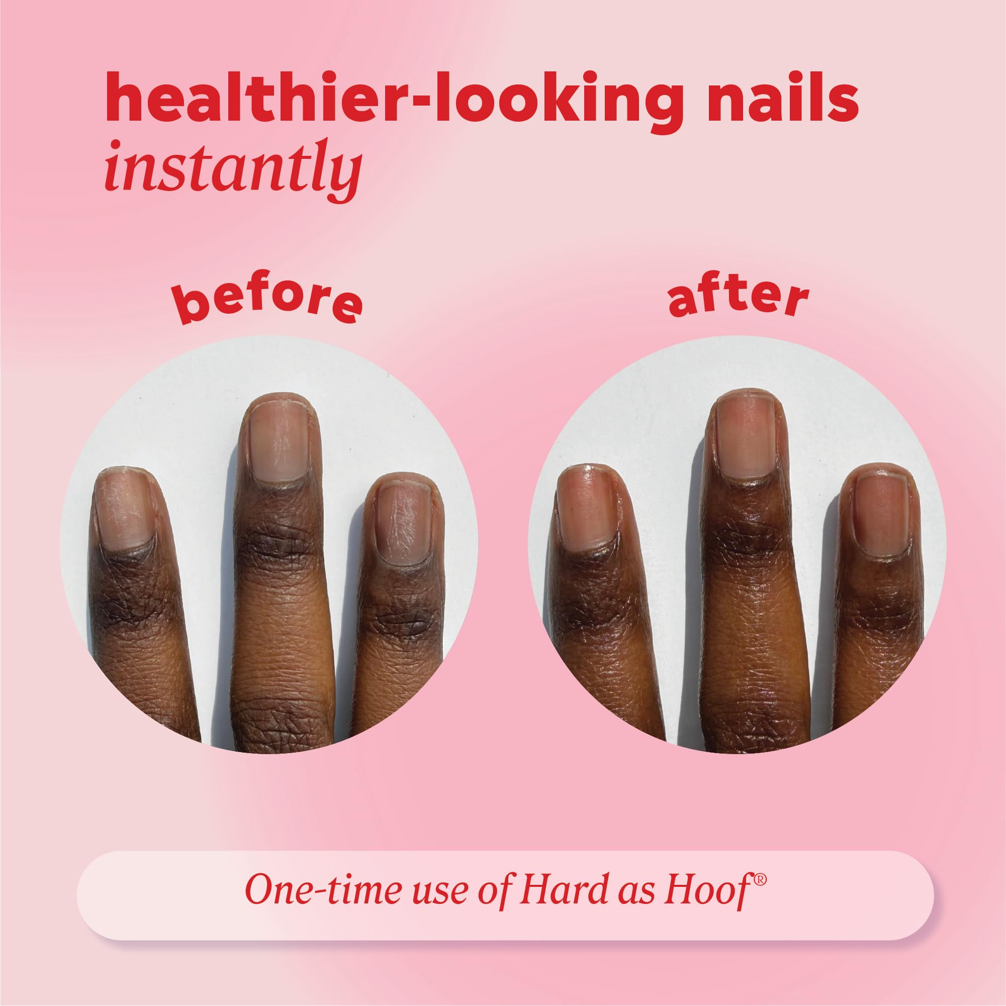 Before and after nails using Onyx Professional showing repaired, stronger nails