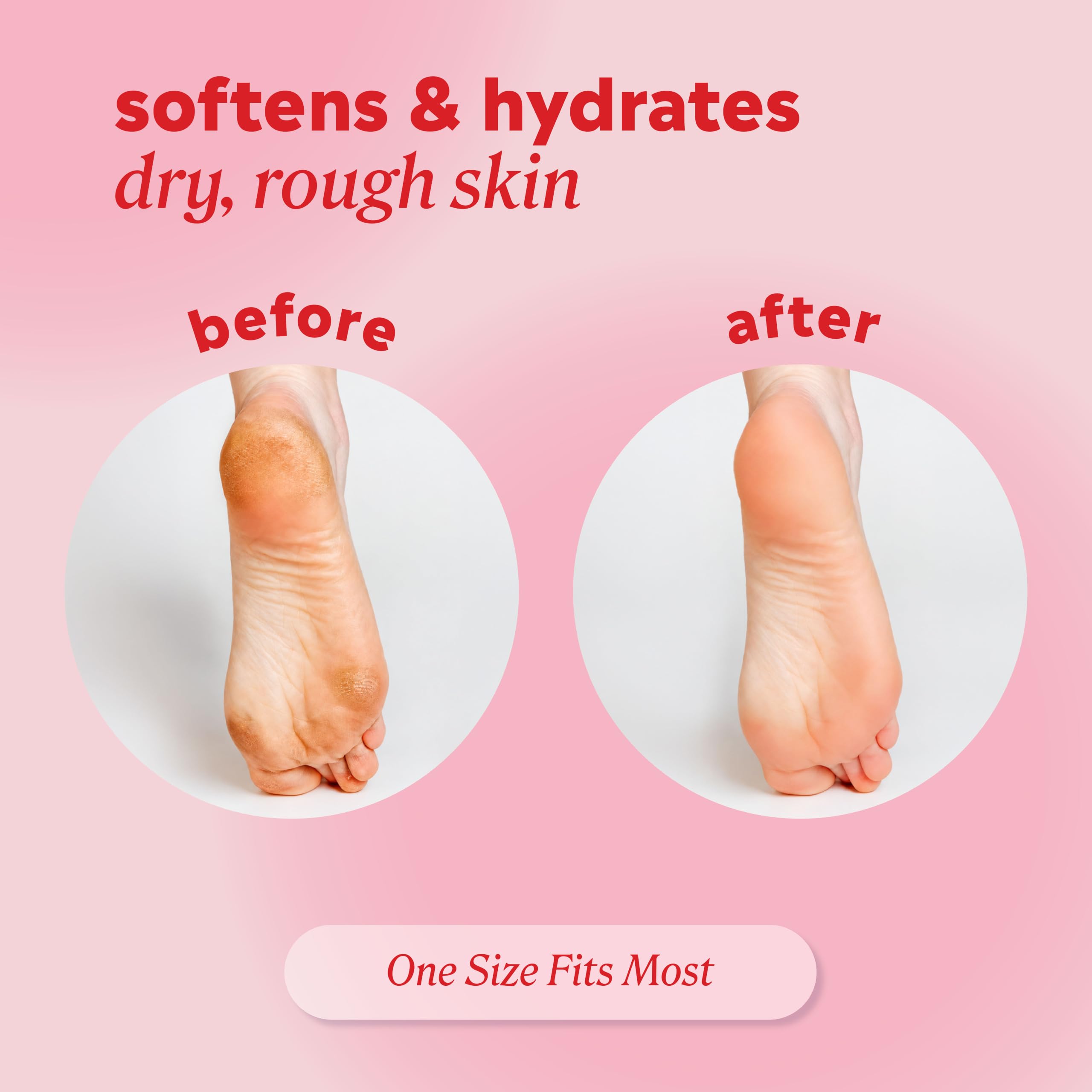 Onyx Professional socks worn during treatment for deep hydration
