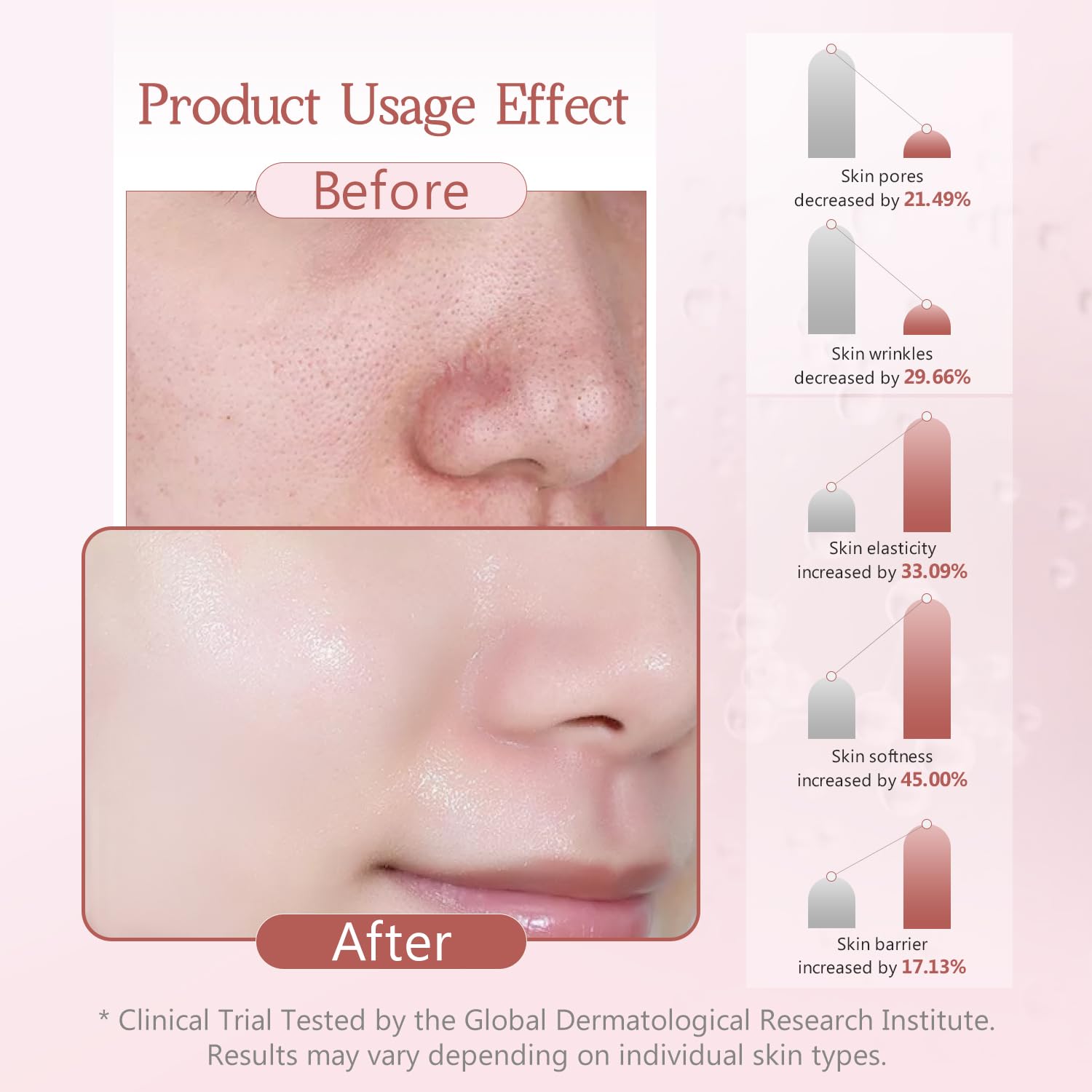 ORDIFEN peeled mask removal, illustrates clean lift-off and refreshed skin