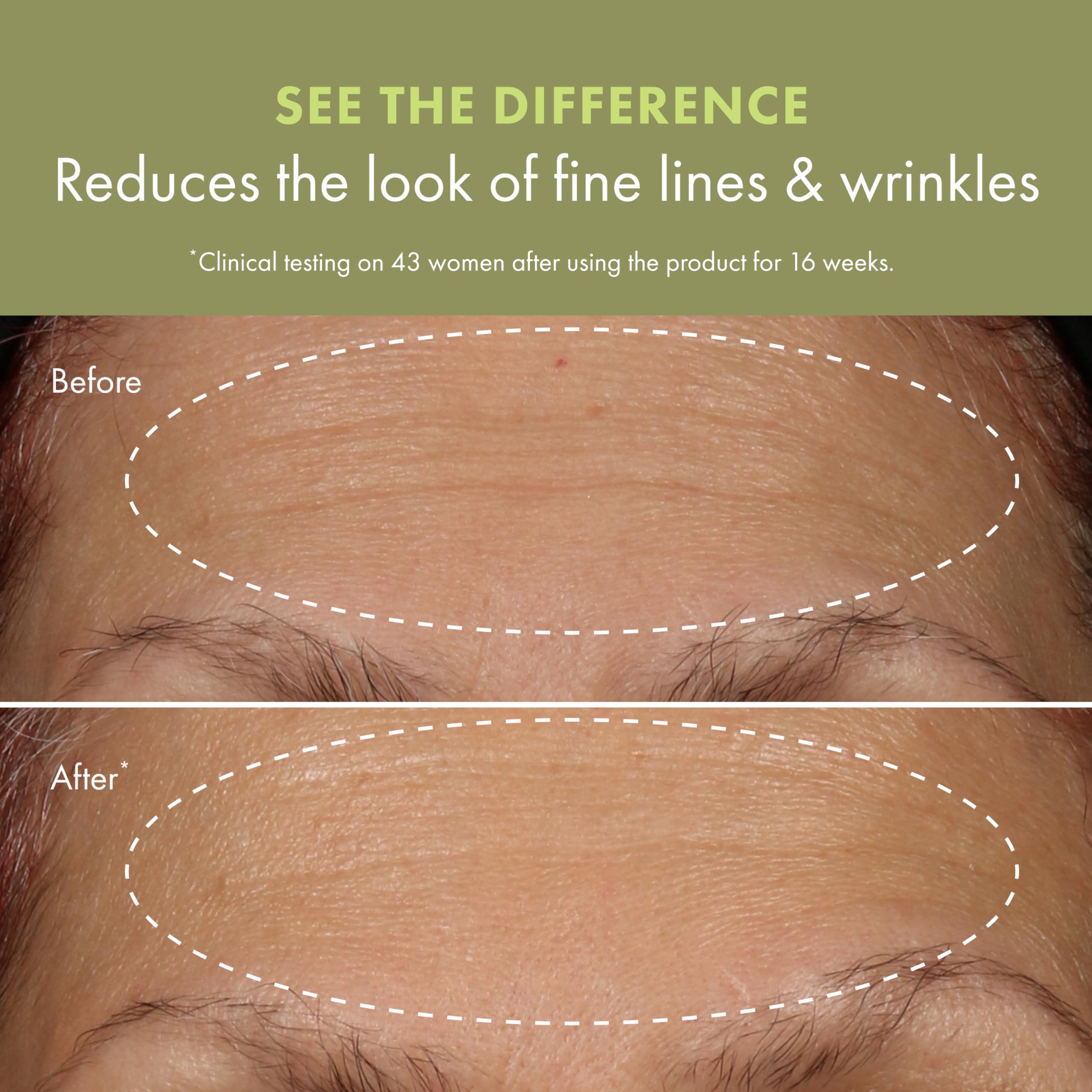 Origins Plantscription applied to neck and jawline showing targeted lift and smoothing benefit
