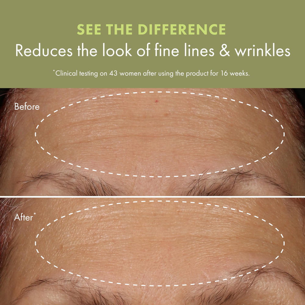 Origins Plantscription applied to neck and jawline showing targeted lift and smoothing benefit
