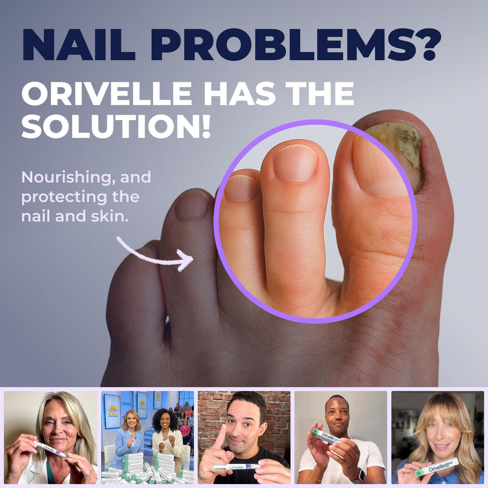 Orivelle before and after nails illustrating improved appearance