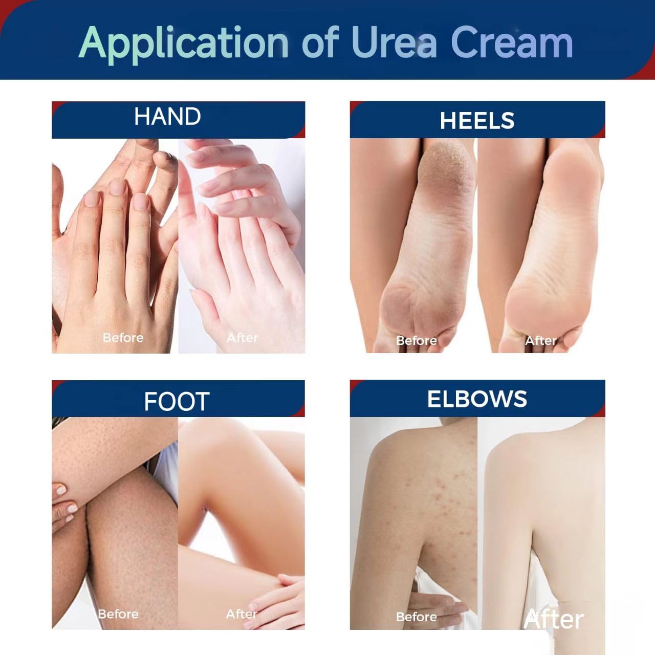 OUKEYA label close-up showing active urea and salicylic acid benefits