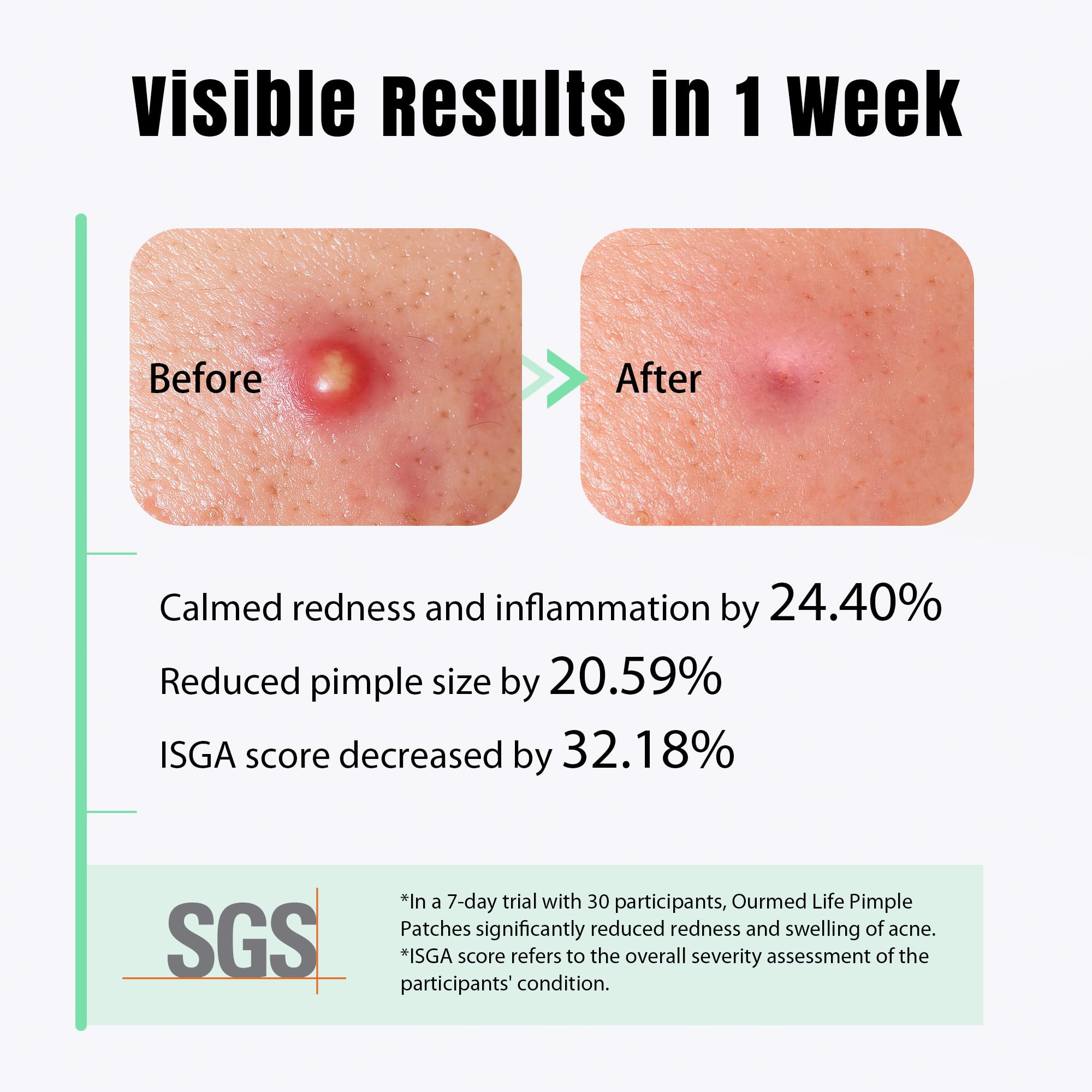 ourmed life patch applied on cheek overnight demonstrating protective use