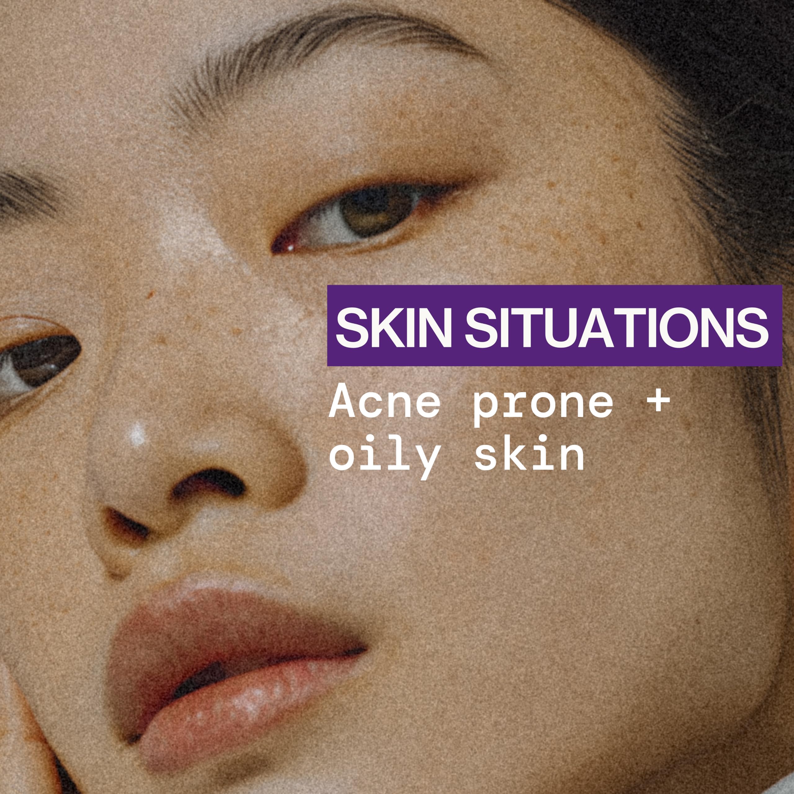 Person applying Pacifica mist to cheek for targeted blemish control
