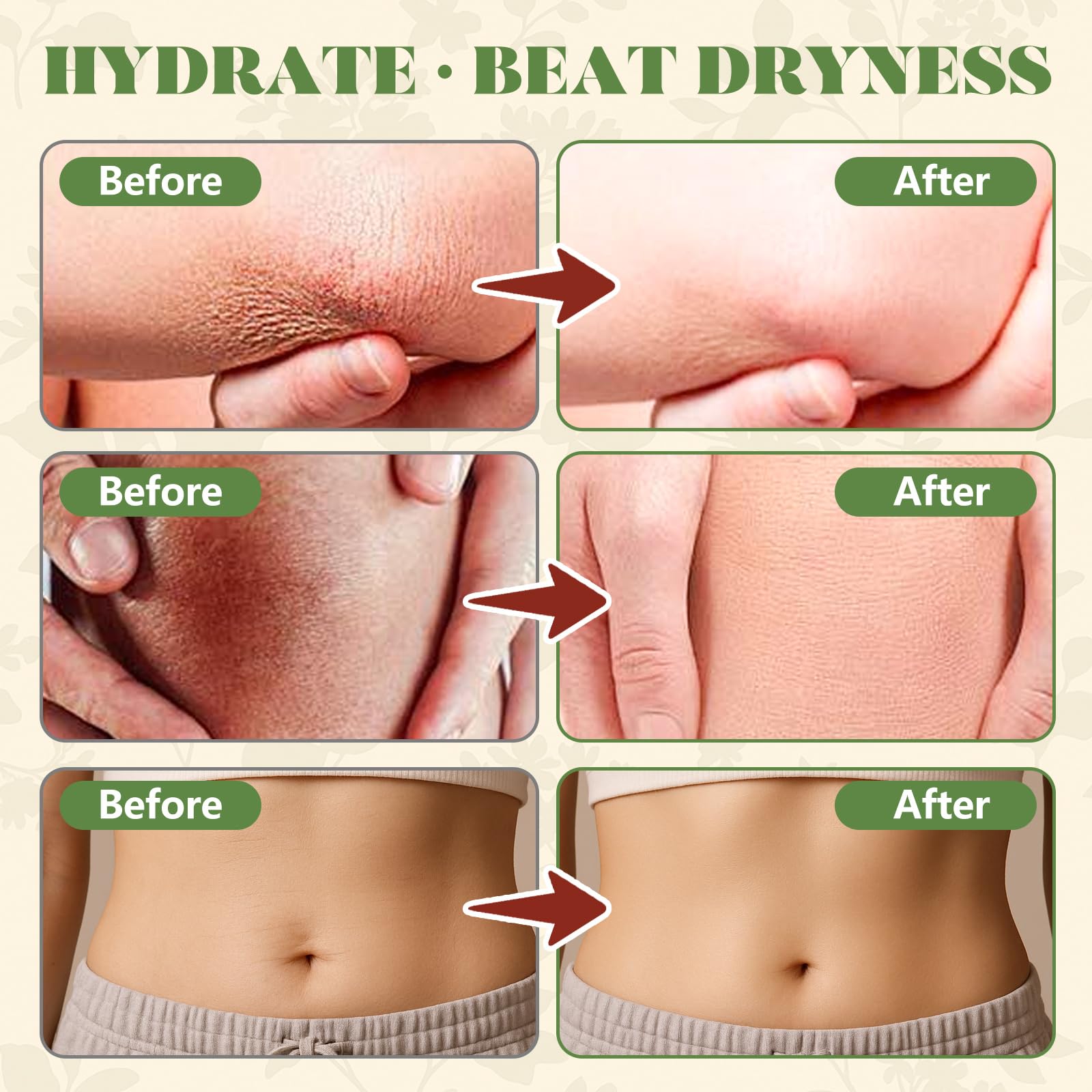 Woman applying Paistely cream to forearm demonstrating easy absorption and soothing hydration