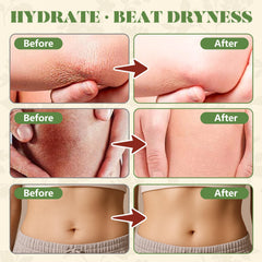 Woman applying Paistely cream to forearm demonstrating easy absorption and soothing hydration
