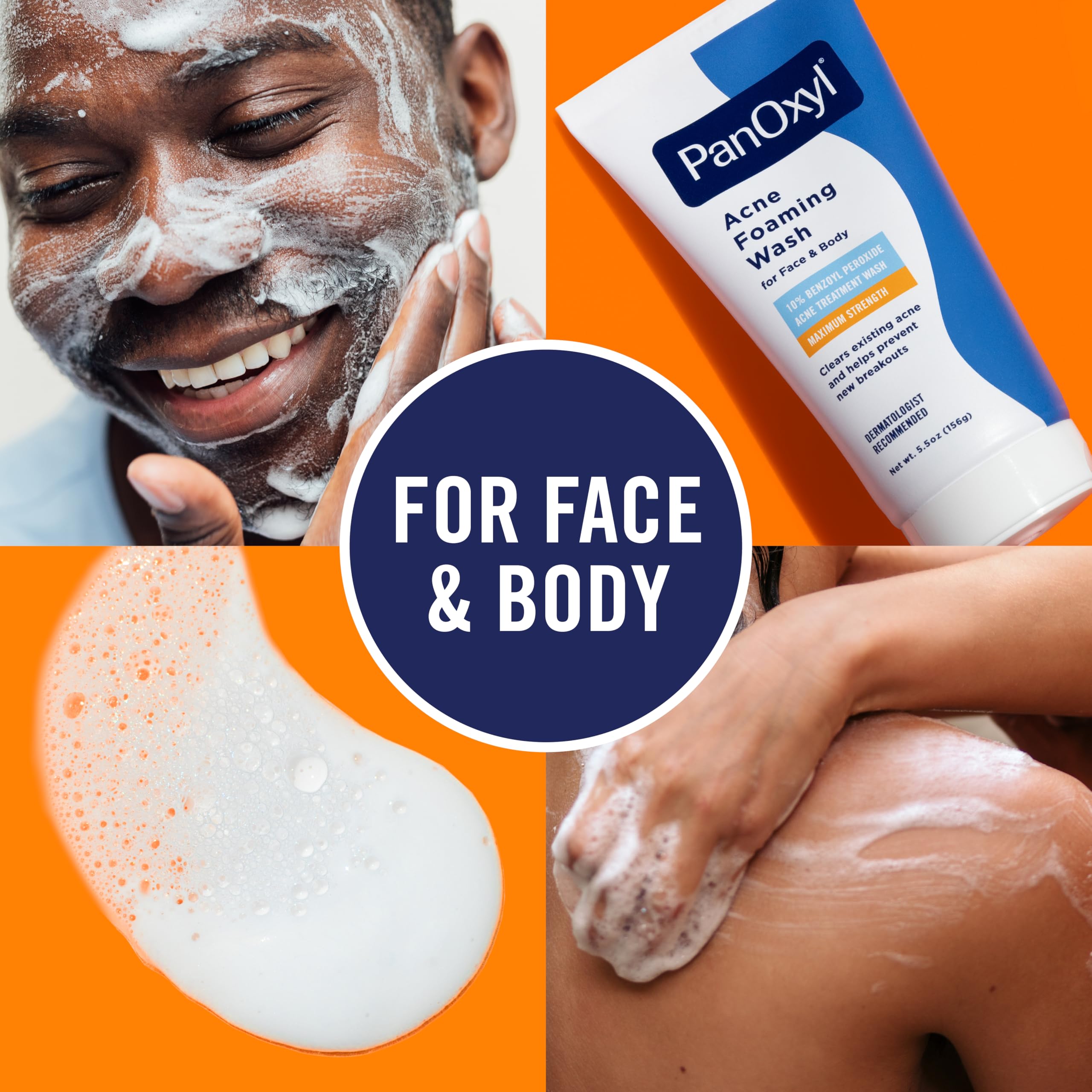 PanOxyl being applied to face illustrating targeted acne treatment