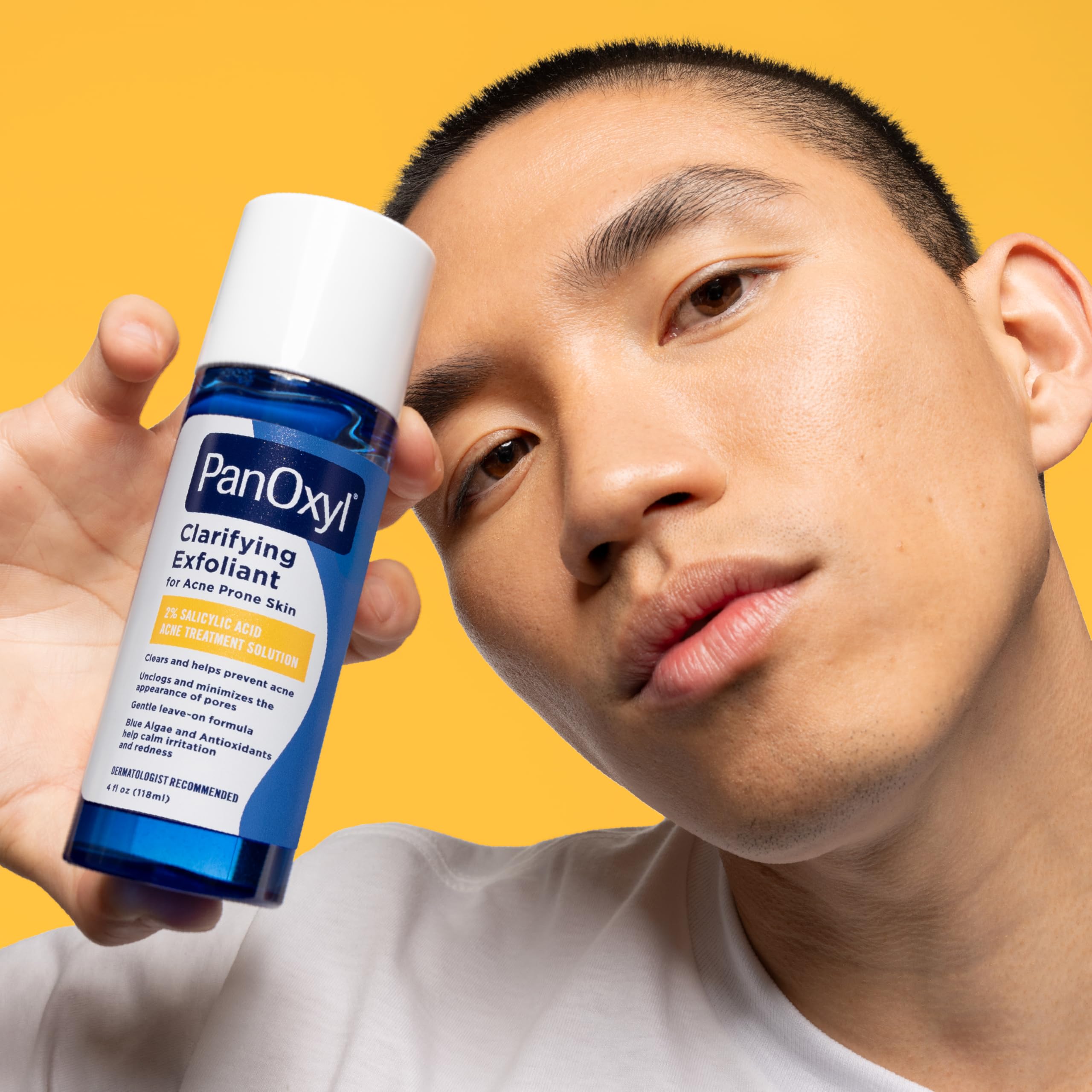 Skin texture after use with PanOxyl showing smoother, less congested pores