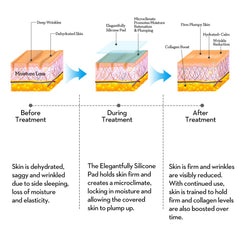 PAPABA pad applied on decollete while sleeping illustrating crease protection